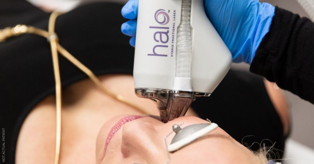 Woman receiving a HALO laser treatment (models)