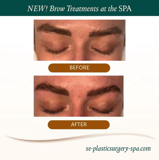 Want brows that perfectly frame your face and enhance your natural beauty? Our new brow services, including tinting, waxing, and lamination, are here to do just that! Our expert aesthetician, Kris Semple, is dedicated to providing you with beautifully shaped defined brows.

Our new brow services include:
🔸 Brow Tinting: Add depth and fullness to your brows with custom color.
🔸 Brow Waxing: Achieve that flawless shape with our precise and gentle waxing.
🔸 Brow Lamination: Get sleek, polished brows that stay in place.

🗓️ To book your appointment with Kris visit the link in bio or call our office at 850.409.6353

#medspalife #expertisematters #browlamination #browwaxing #browtintandwax #browtinting