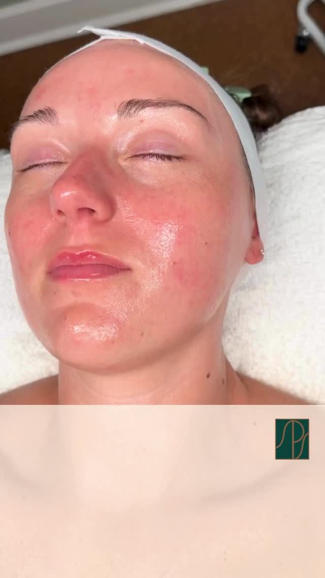 Now through the end of August, enjoy 10% off skincare products when you schedule both an injectable appointment and a skincare service.

💡 Appointments don’t need to be on the same day or even in August! As long as you book both appointments this month, you’ll still qualify for the promotion when your services are completed.

📍 In-office only promotion. Cannot be combined with 25th Anniversary gift cards.

Call us today at 850.219.2000 to reserve your appointments and take advantage of this limited-time offer!