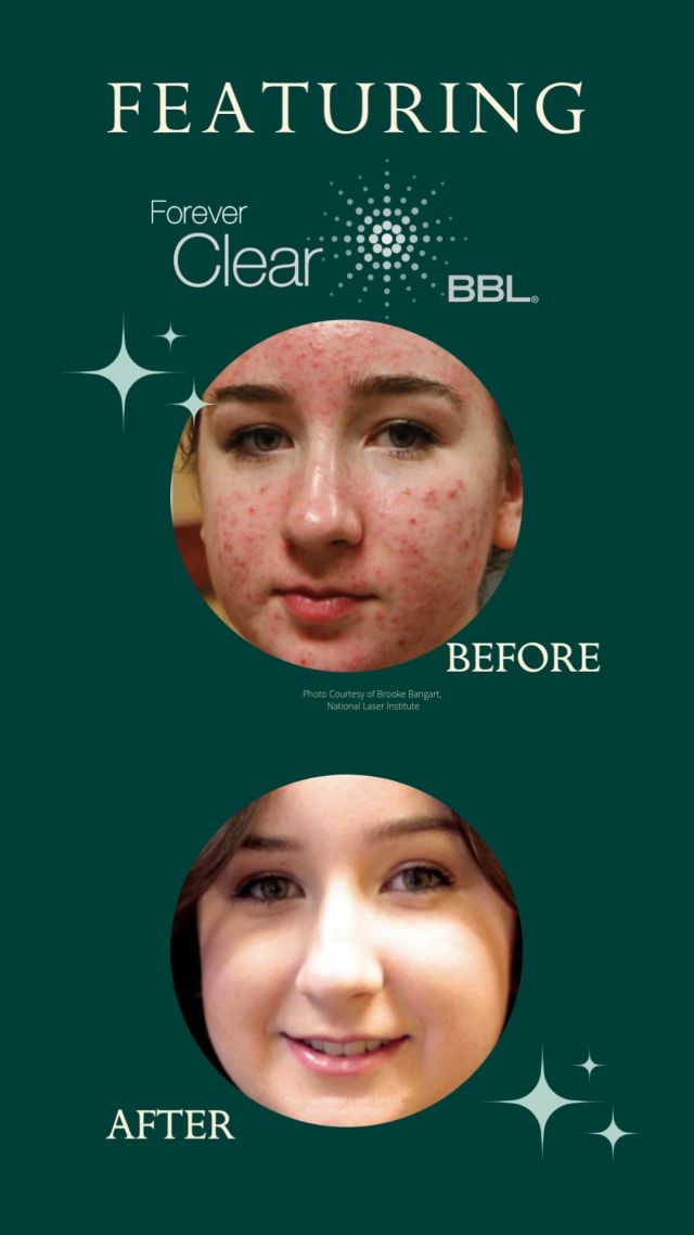 ✨ Book Now for 2026 ✨
Southeastern Plastic Surgery & the Spa is proud to introduce the Sciton Joule™ platform, EXCLUSIVE TO OUR AREA!

The Joule™ features:
🌟 BBL HEROic™ – next-generation BroadBand Light® for correcting sun damage, redness, acne, and more with minimal downtime.
🌟 HALO® – the world’s first hybrid fractional laser, designed to erase years of skin damage and restore a luminous, youthful glow.
🌟 ContourTRL™ – the gold standard in deep resurfacing for fine lines, wrinkles, and advanced skin rejuvenation.

Together, these advanced treatments address everything from early signs of aging to complex skin concerns, delivering customizable, long-lasting results.

📞 Call us today at 850.810.0964  or visit se-plasticsurgery.com to schedule your consultation and discover which treatment is right for you